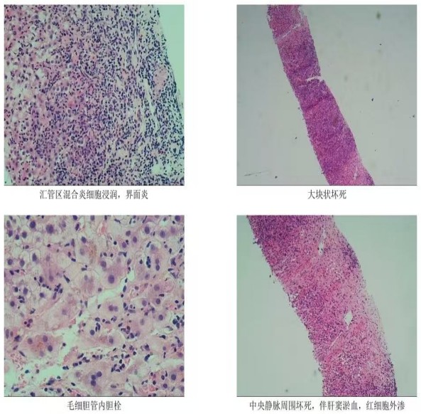 Snipaste_2025-04-28_08-32-27.jpg Snipaste_2025-04-28_08-32-27.jpg